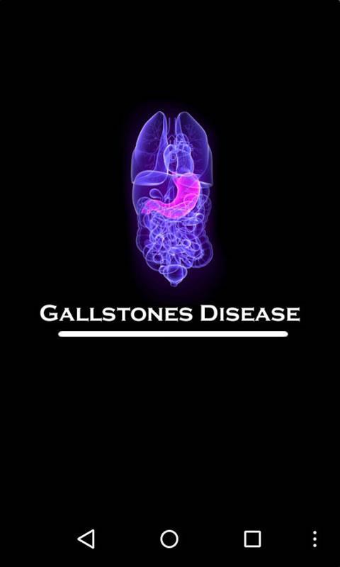 Gallstones Disease