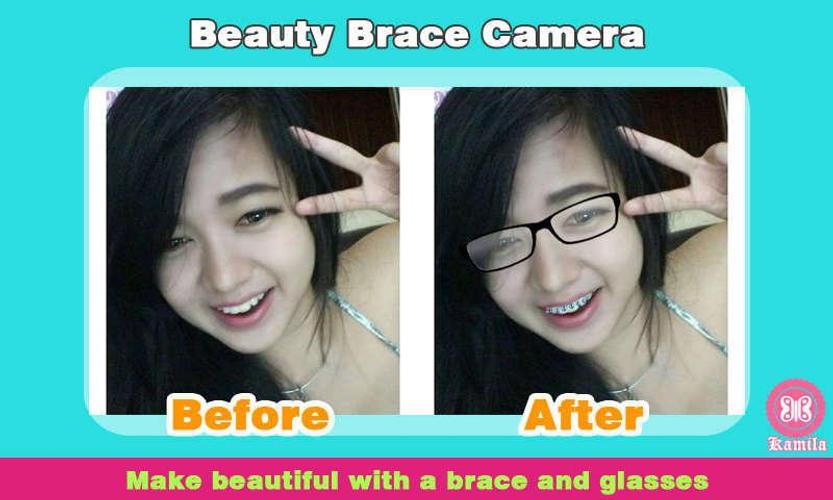 Beauty Brace Camera